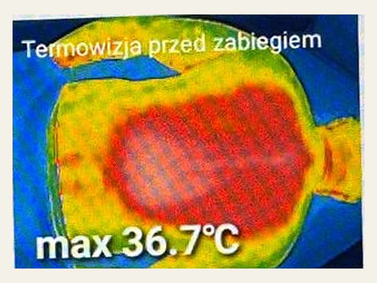 Obraz termowizyjny pleców przed sesją, temperatura maksymalna 36,7 stopnia Celsjusza